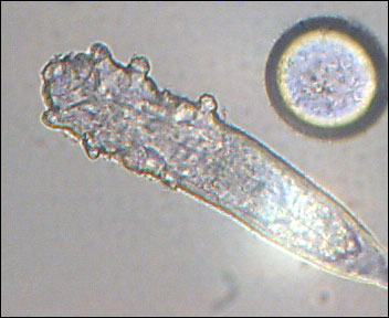 Demodex folliculorum